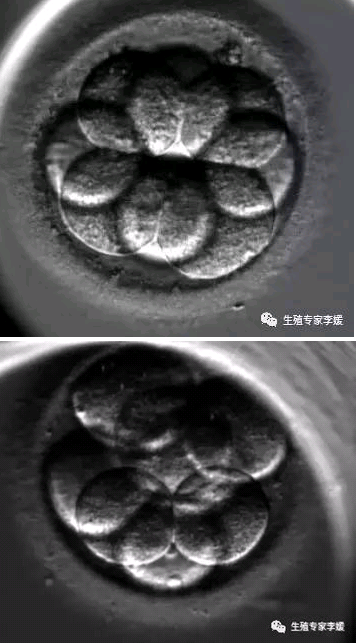 �����ʽ��� ����ֲ��̥��